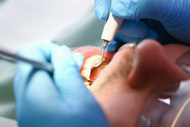 Best Weekend Emergency Dentist in Braidwood, IL
